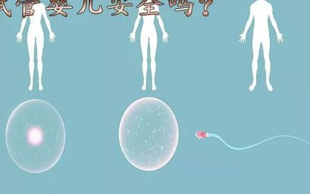 呼和浩特有哪些技术好的试管婴儿医生？